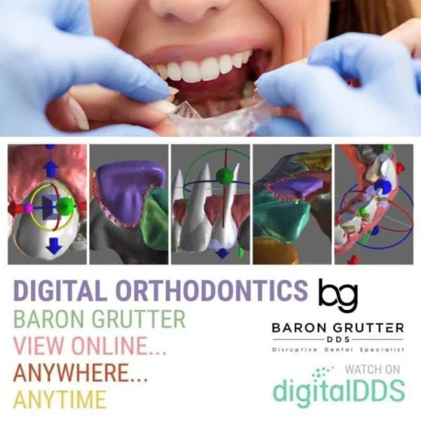 Digital Orthodontics (Clear Aligners)